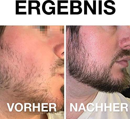 Produktbild Vinsk Dermaroller