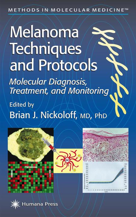 Produktbild Melanoma Techniques and Protocols (Englisch, 2011)