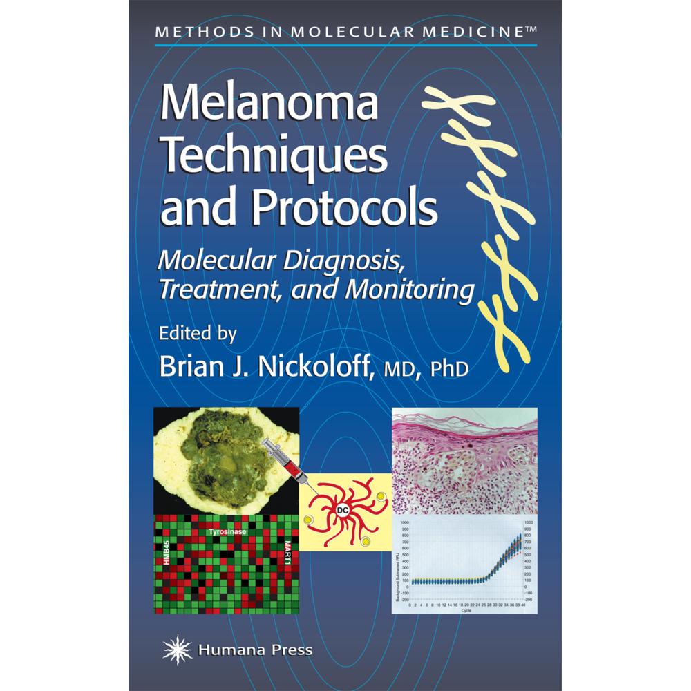 Melanoma Techniques and Protocols, Sachbücher