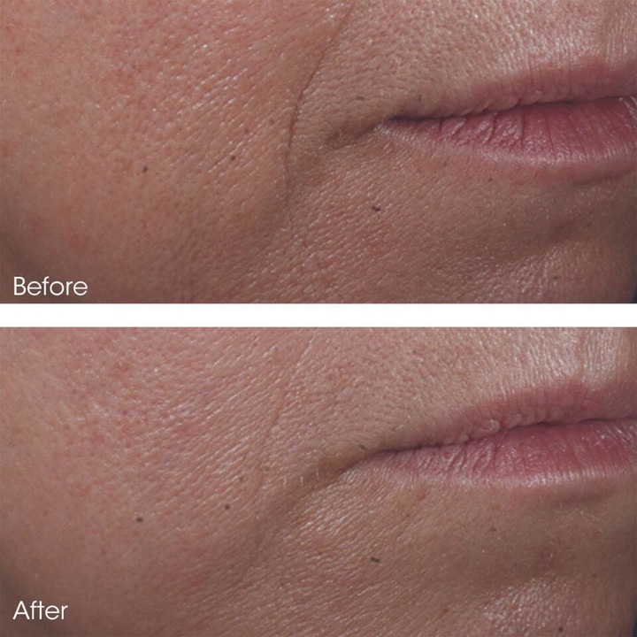 Actual product image Perricone MD Cold Plasma Plus+ Advanced Serum Concentrate Women 30 ml (Serum, 30 ml)