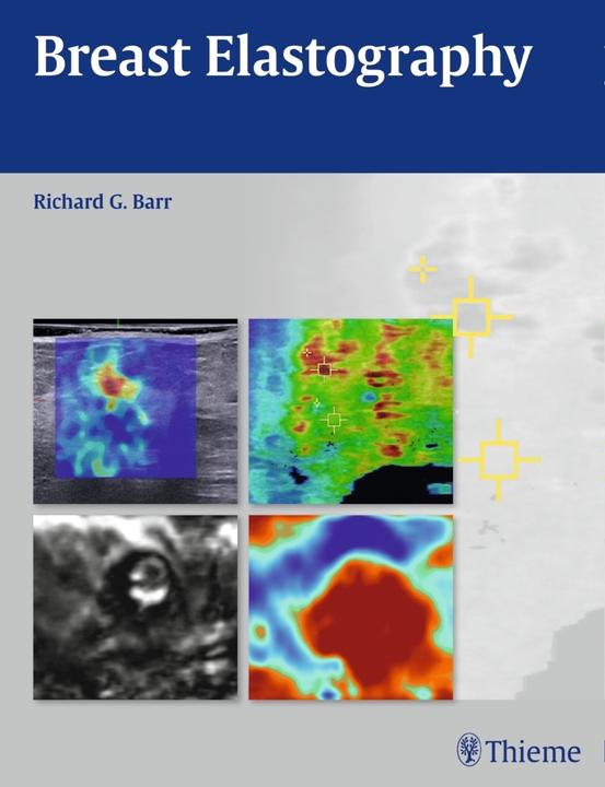 Actual product image BARR, Breast Elastography, A1, print (English, Richard G. Barr, 2014)