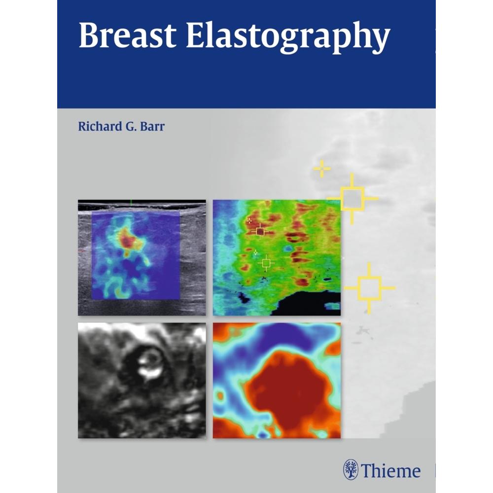 BARR, Breast Elastography, A1, print, Fachbücher von Richard G. Barr