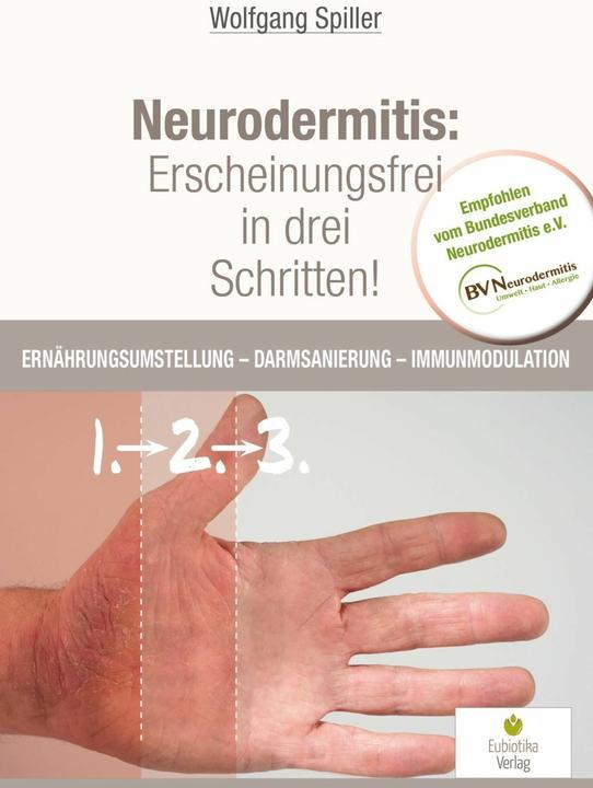 Produktbild Neurodermitis: Erscheinungsfrei in drei Schritten! (Deutsch, Spiller Wolfgang, 2017)