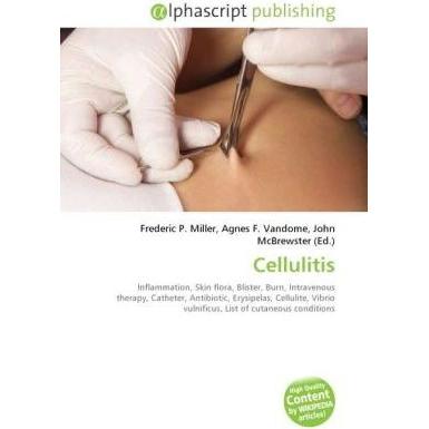 Cellulitis, Fachbücher von Agnes F. Vandome, Frederic P. Miller, John McBrewster