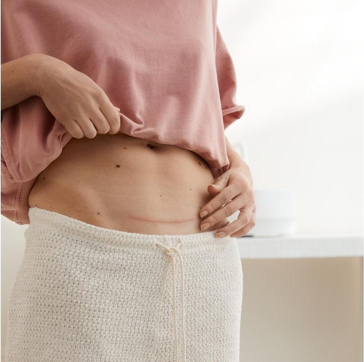 Actual product image Hansaplast Narben Reduktion Pflaster XL (21 x)