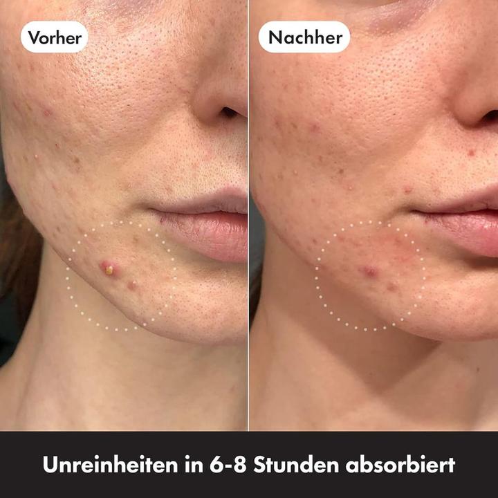 Immagine prodotto Hero.Mighty Patch Invisibile+ (197.28 ml)