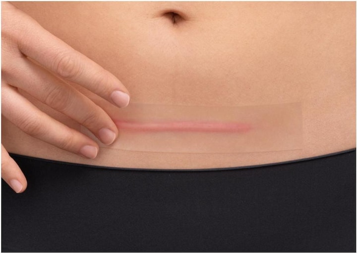 Actual product image Hansaplast Narben Reduktion Pflaster XL (21 x)