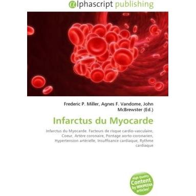 Infarctus du Myocarde, Ratgeber von Frederic P. Miller, John McBrewster, Agnes F. Vandome