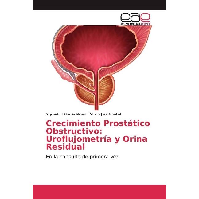 Crecimiento Prostático Obstructivo: Uroflujometría y Orina Residual, Fachbücher von Sigiberto García Nares, Álvaro José ...