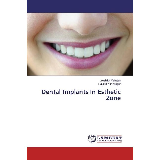 Dental Implants In Esthetic Zone, Fachbücher von Rajesh Kshirsagar, Vrushika Mahajan