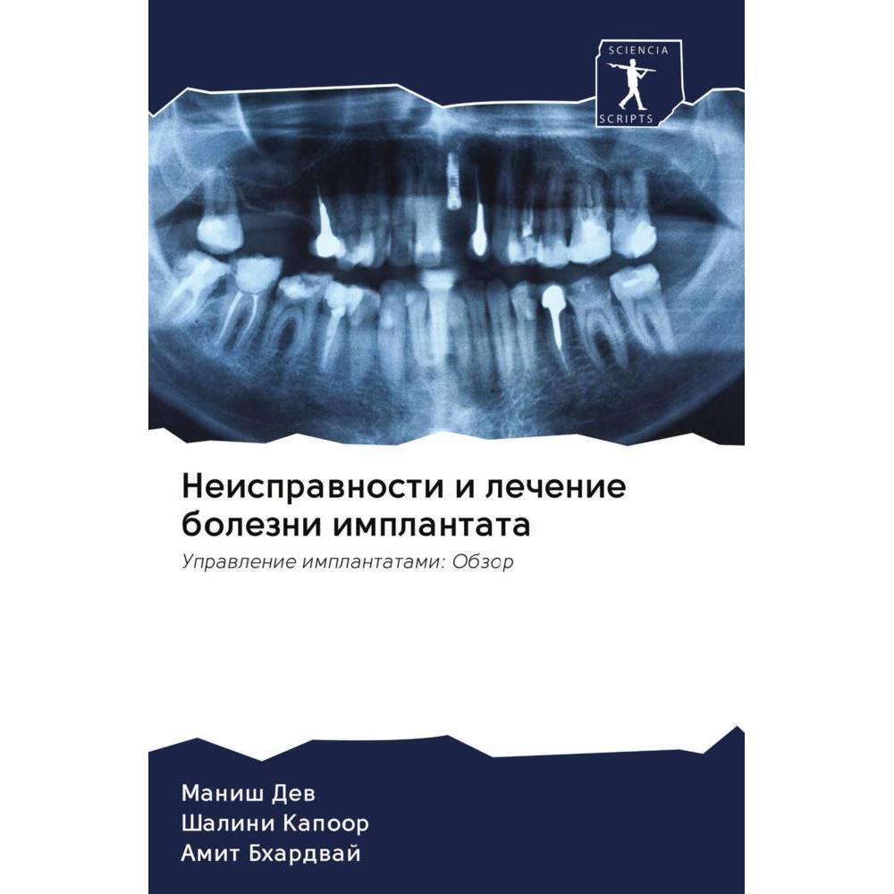 Neisprawnosti i lechenie bolezni implantata, Fachbücher von Amit Bhardwaj, Shalini Kapoor, Manish Dew