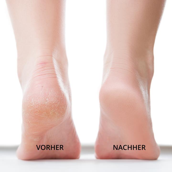 Immagine prodotto Ailoria Lustre Pro