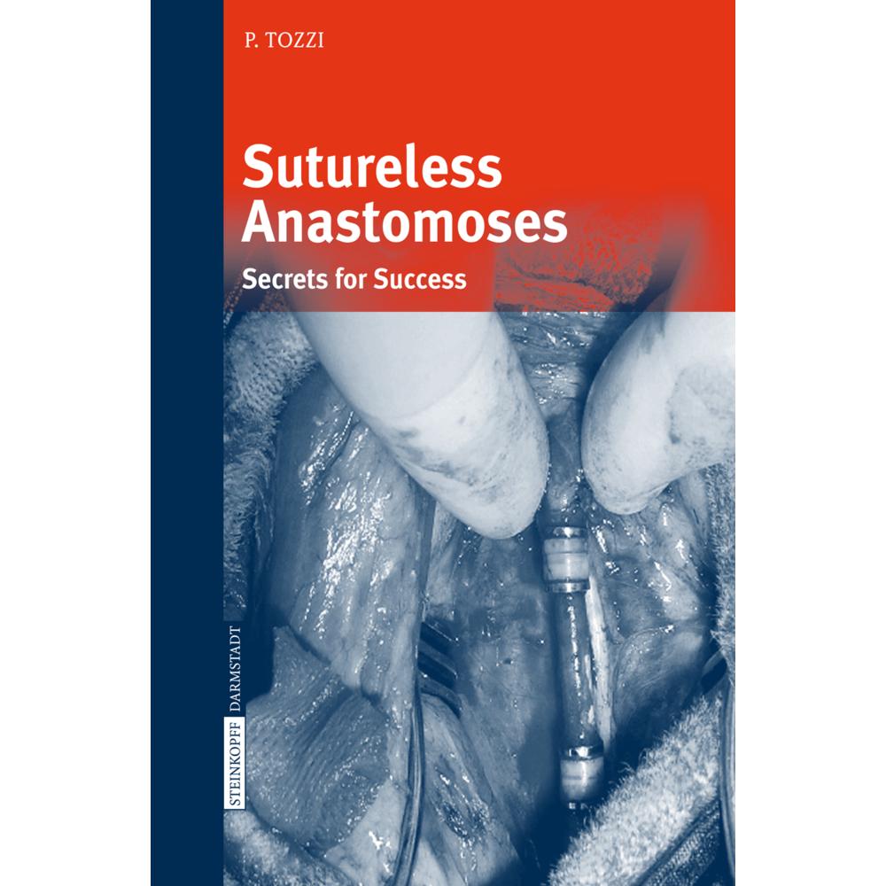 Sutureless Anastomoses, Fachbücher von Piergiorgio Tozzi