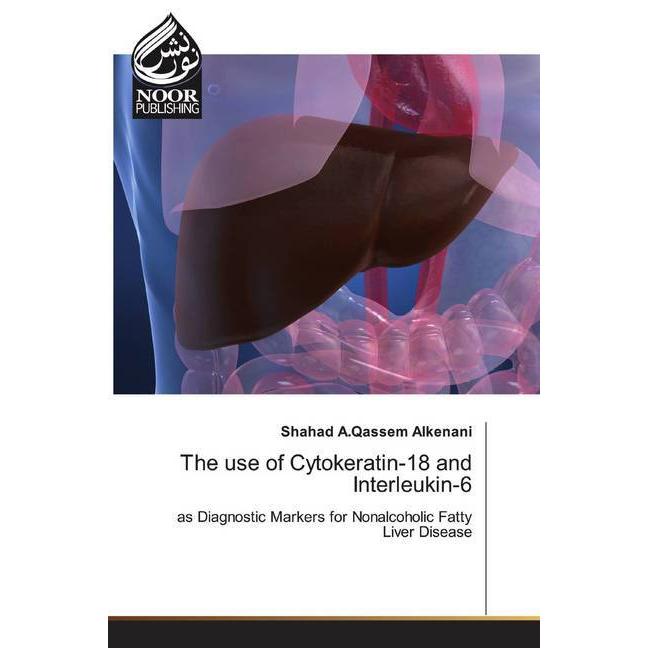 The use of Cytokeratin-18 and Interleukin-6, Fachbücher von Shahad A.Qassem Alkenani