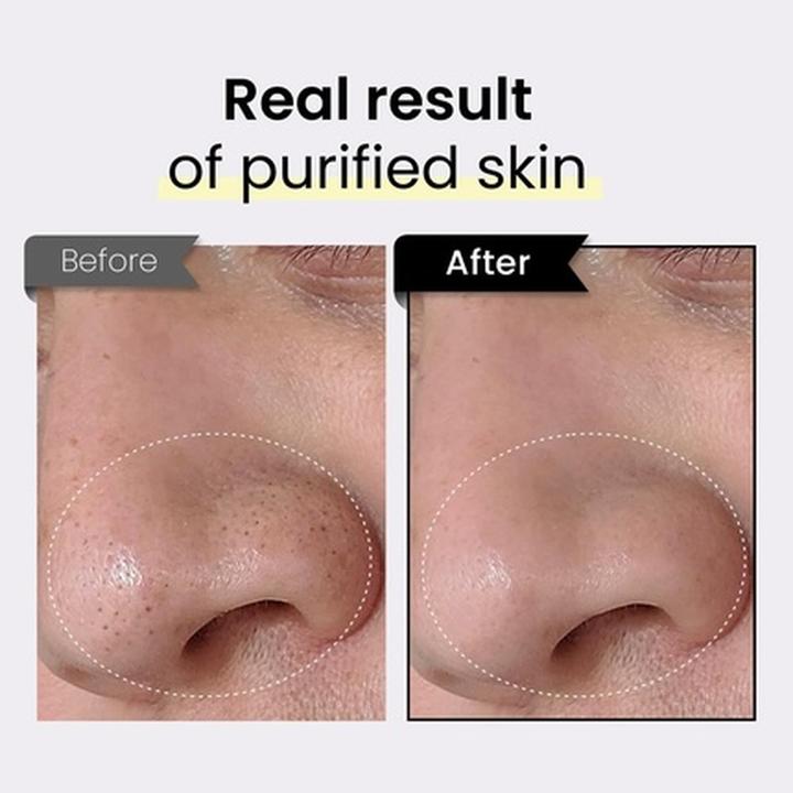 Image du produit Coxir Black Rice Txa Pore Purifying Mask with Tranexamic Acid 3-in-1 Detox Serum (50 ml)