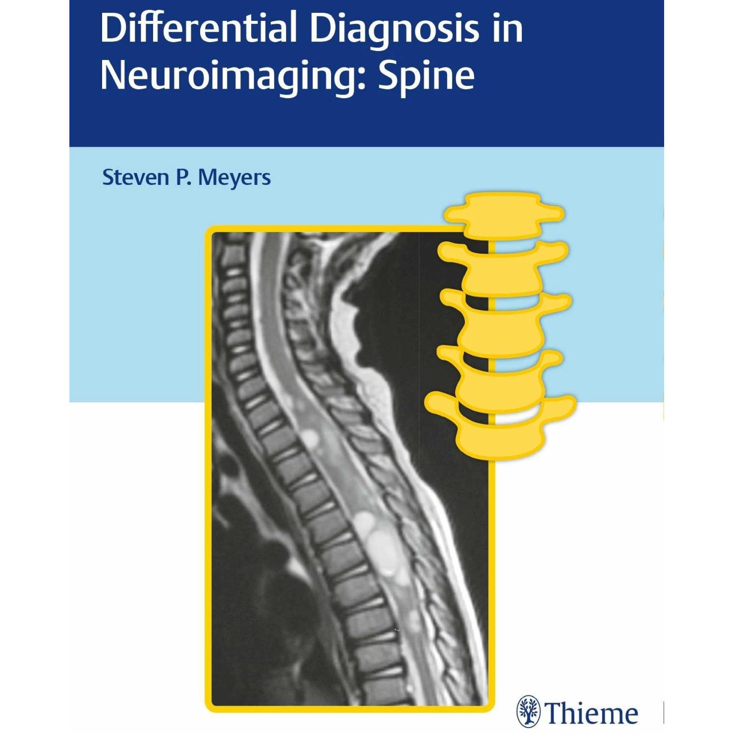 Diff.Diagn.Neuroimaging - Spine, Fachbücher von Steven Meyers