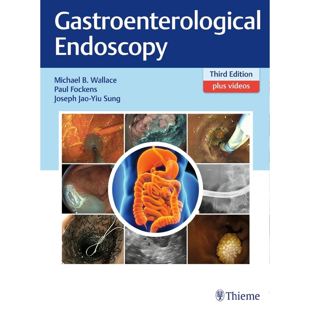 Gastroenterological Endoscopy, Sachbücher von Paul Fockens, Michael B. Wallace, Joseph Jao-Yiu Sung
