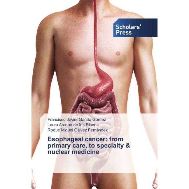 Esophageal cancer: from primary care, to specialty & nuclear medicine, Fachbücher von Francisco Javier García Gómez, Lau...