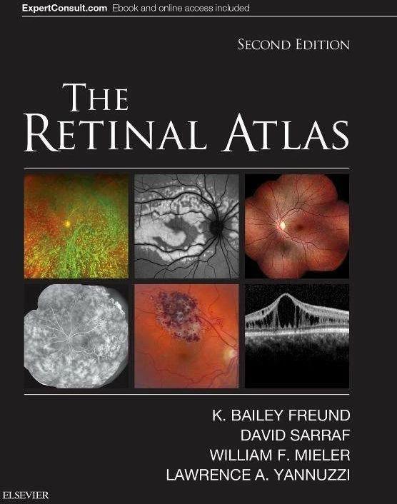 The Retinal Atlas (Englisch, David Sarraf, K. Bailey Freund, Lawrence A. Yannuzzi, William F. Mieler, 2017)