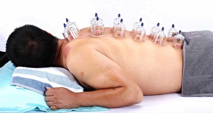 Actual product image AcuTop Cupping set, 19 pieces