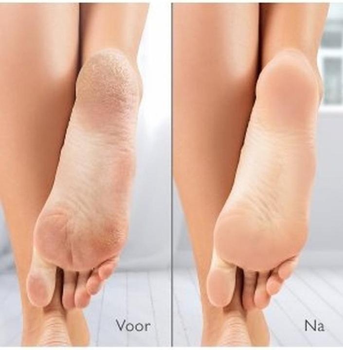 Produktbild Silk'n VacuPedi