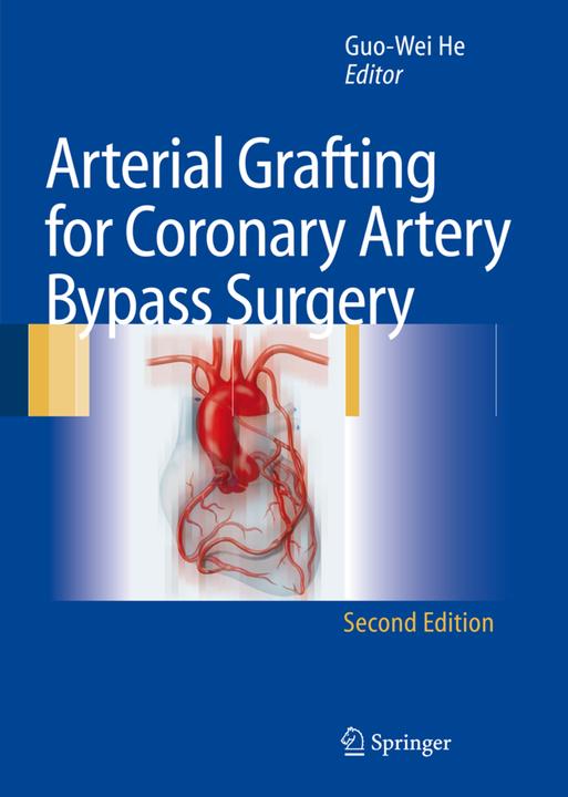 Arterial Grafting for Coronary Artery Bypass Surgery (Englisch, Guo-Wei He, 2010)