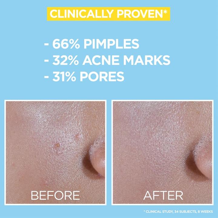 Actual product image Garnier Pure Active BHA + Niacinamide Daily UV Anti-Imperfection Fluid (Suntan cream, SPF 50, 40 ml)