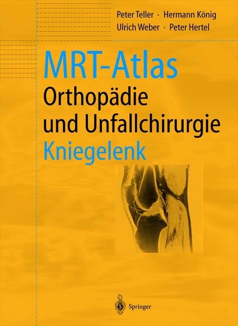 Produktbild MRT-Atlas Orthopädie und Unfallchirurgie (Deutsch, Hermann König, Peter Hertel, Peter Teller, Ulrich Weber, 2012)