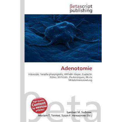 Adenotomie, Fachbücher von Lambert M. Surhone, Mariam T. Tennoe, Susan F. Henssonow