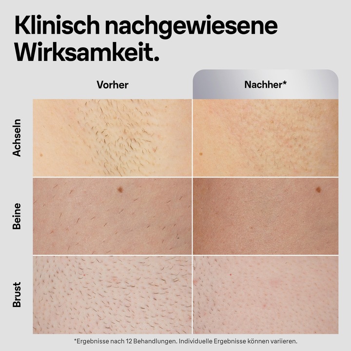 Produktbild Braun Silk·expert Pro 5