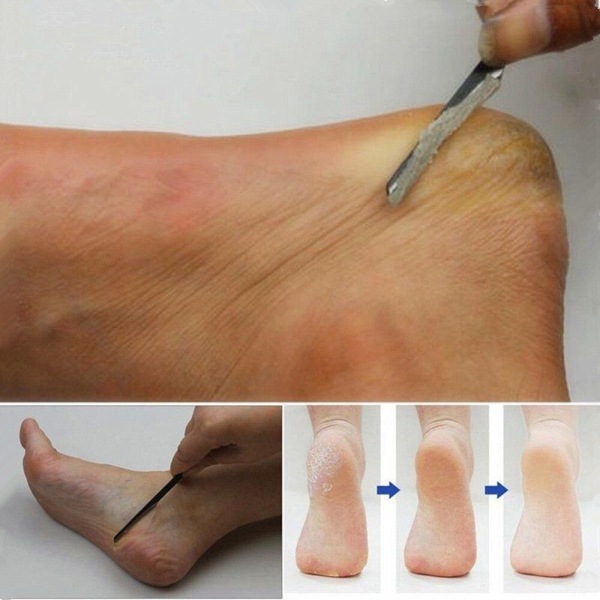 Produktbild Nagellack24 Hornhautschaber