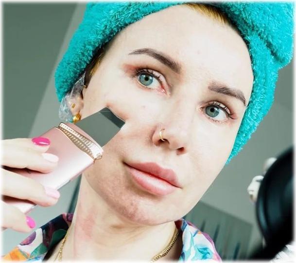 Produktbild Garett Beauty Sonic Scrub pink cavitation peeling