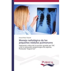 Manejo radiológico de los pequeños nódulos pulmonares, Fachbücher von Eduard Mauri Paytubi