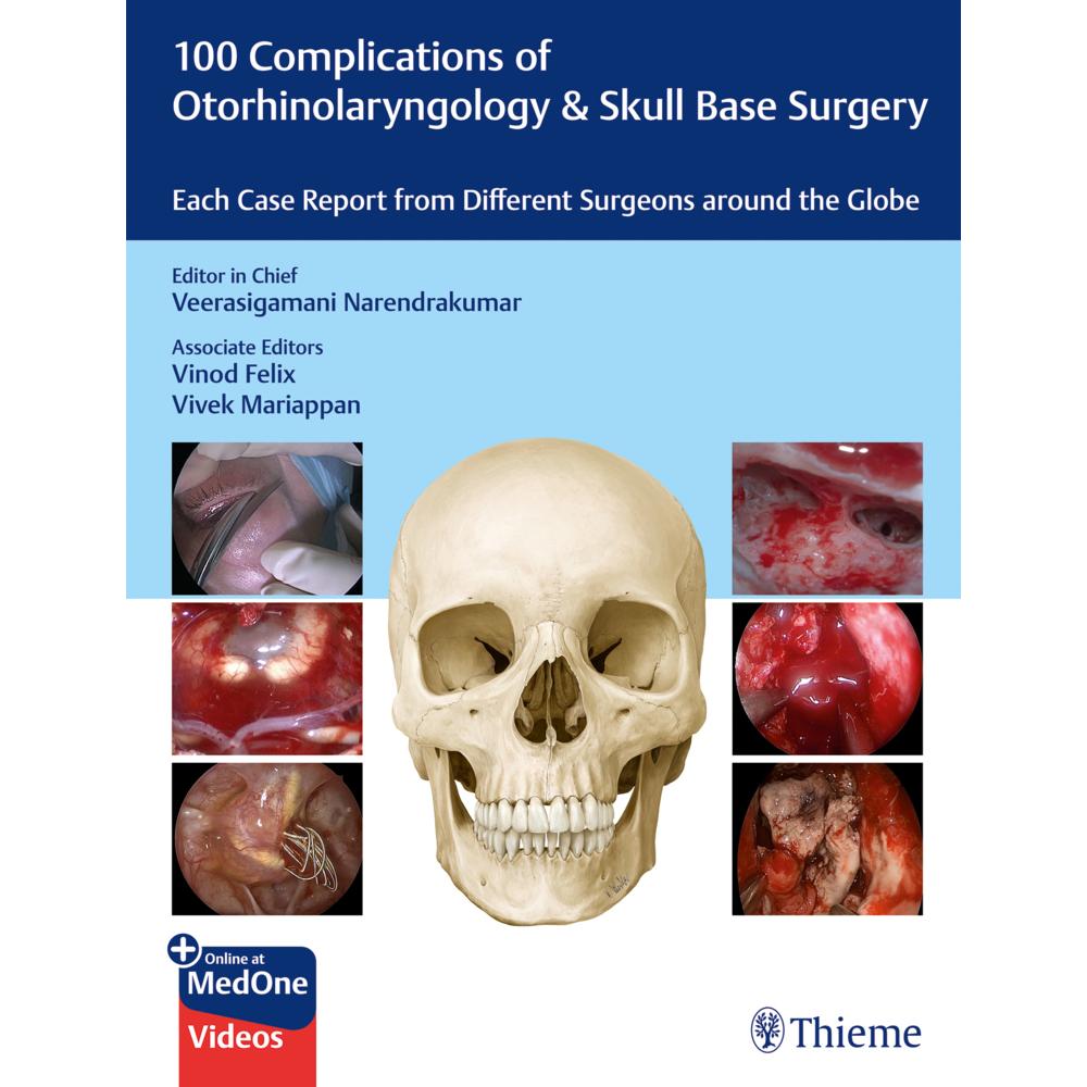 100 Complications of Otorhinolaryngology & Skull Base Surgery, Fachbücher von Veerasigamani Narendrakumar
