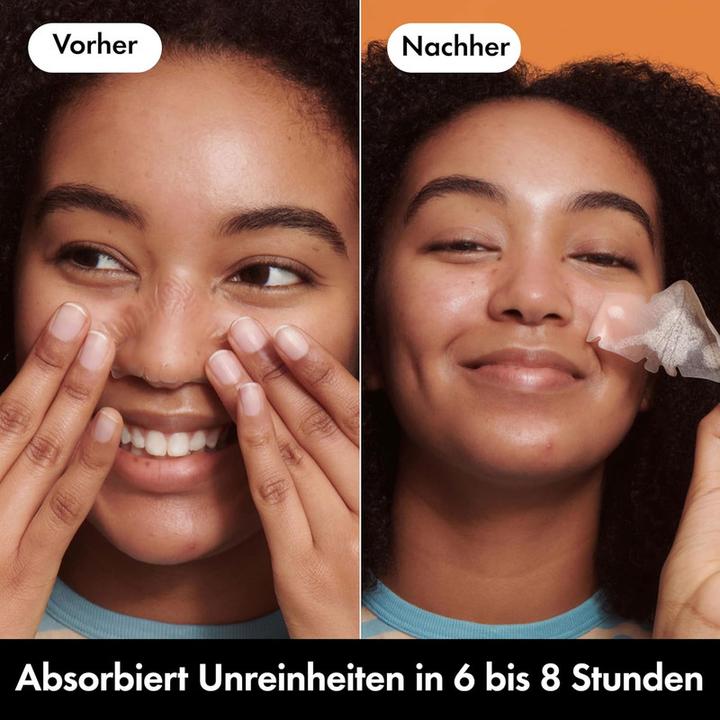 Actual product image Church & Dwight Mighty Patch