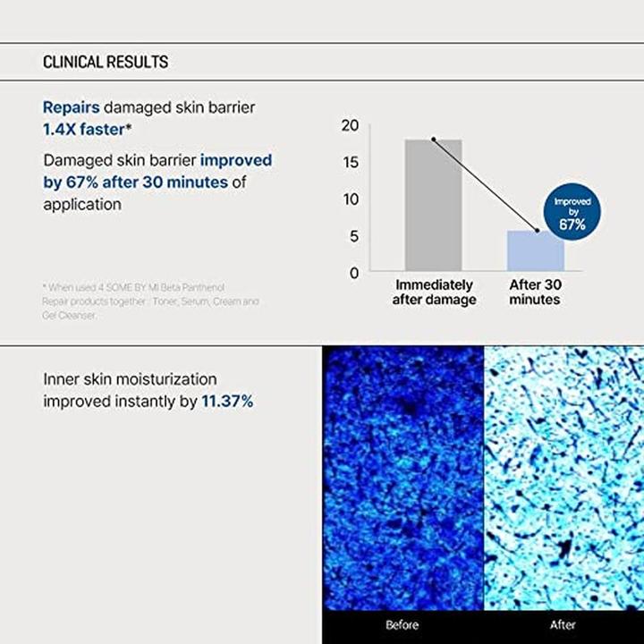 Immagine prodotto Some By Mi Beta Panthenol (Tonico per il viso, 150 ml)