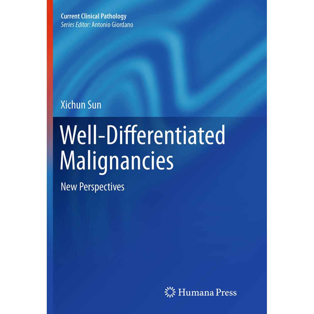 Well-Differentiated Malignancies, Fachbücher von Xichun Sun
