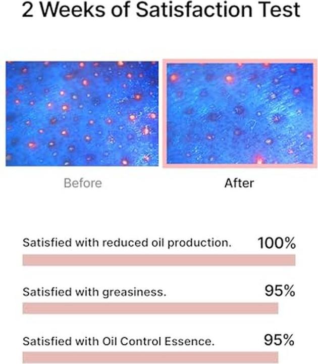 Produktbild Celimax Öl-Kontroll-Kapsel-Essenz (30 ml)