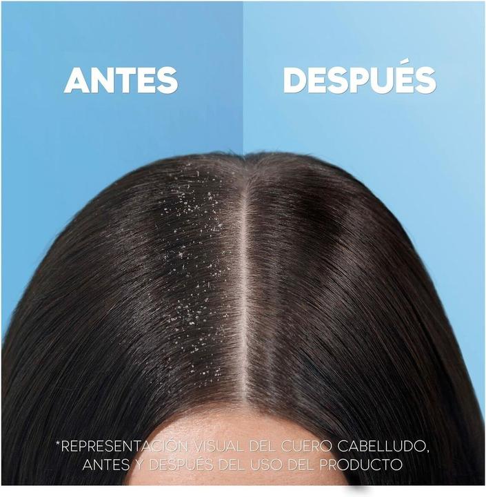 Produktbild Head & Shoulders H&S Zitrus Shampoo 900ml (1000 ml, Flüssiges Shampoo)