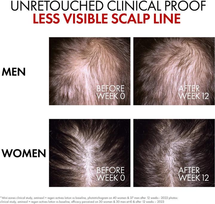 Image du produit Vichy Dercos Aminexil Clinical R.E.G.E.N. (90 ml)