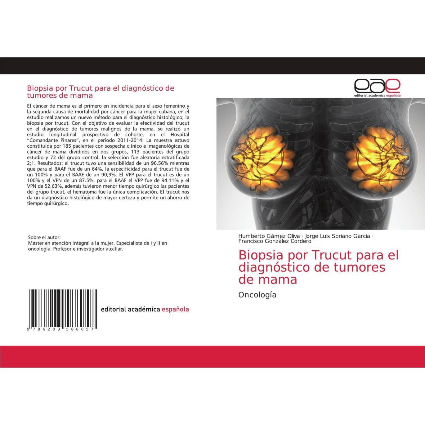 Biopsia por Trucut para el diagnóstico de tumores de mama, Fachbücher von Francisco González Cordero, Humberto Gámez Oli...