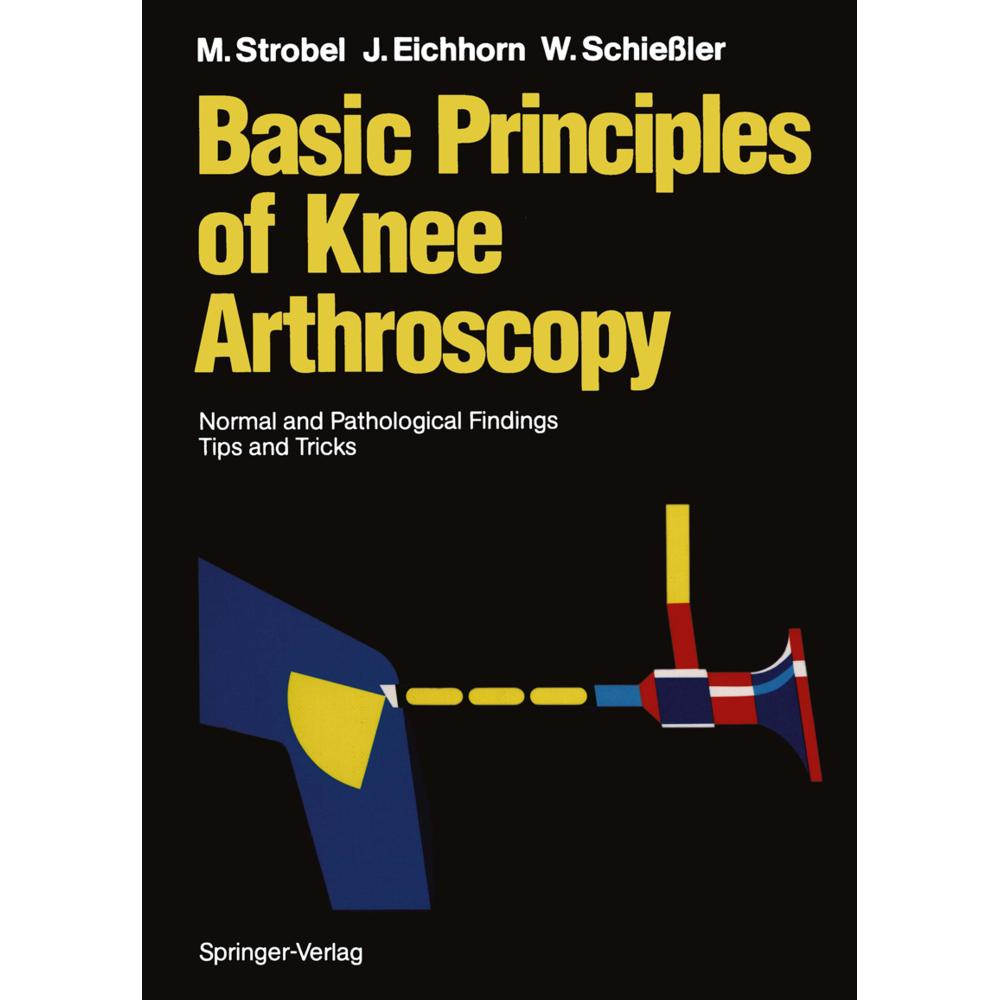 Basic Principles of Knee Arthroscopy, Fachbücher von Michael Strobel, Wilfried Schiessler, Heinz-Jürgen Eichhorn