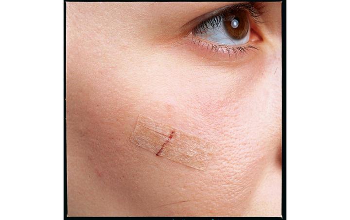 Actual product image Nexcare Steri-Strip wound closure strips (6 x)