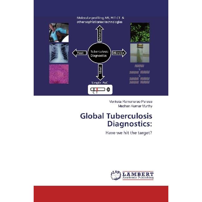 Global Tuberculosis Diagnostics:, Fachbücher von Venkata Ramanarao Parasa, Madhan Kumar Murthy