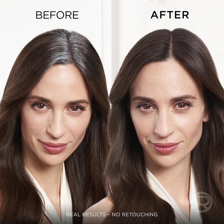 Immagine prodotto L'Oréal Paris L'Oreal - Magic Retouch Spray correttore istantaneo per le radici (Marrone scuro)