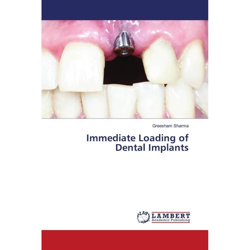 Immediate Loading of Dental Implants, Fachbücher von Greesham Sharma