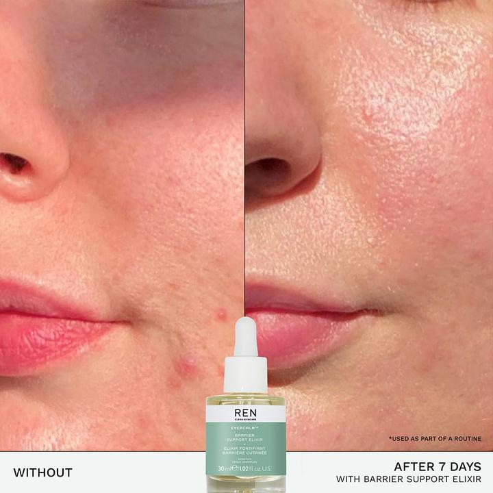 Actual product image Ren Evercalm Barrier Support Elixir 30 ml (30 ml)
