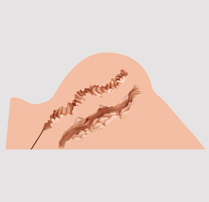 Image du produit Naked Factory Hannah, la fille de la fantaisie