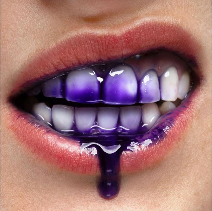 Image du produit SmilePen Instasmile (30 ml, Kit de blanchiment)