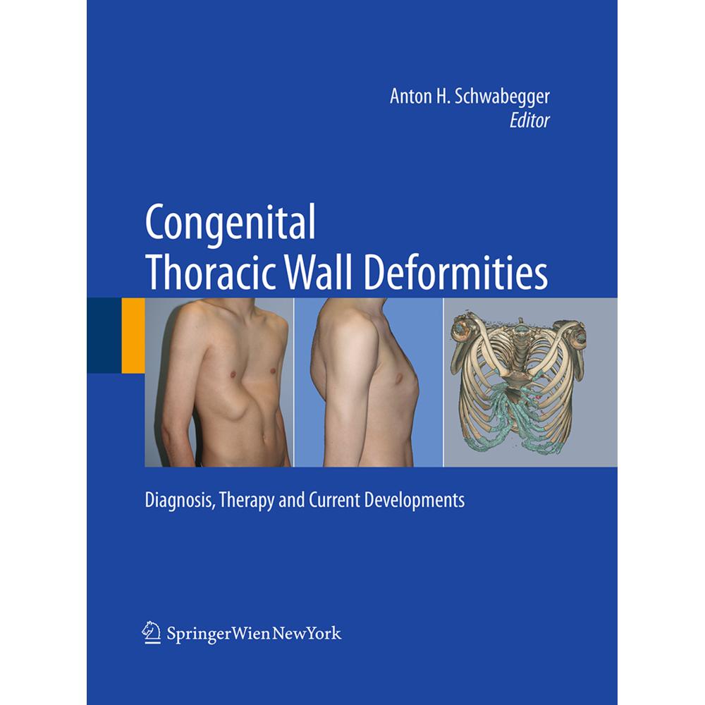 Congenital Thoracic Wall Deformities, Fachbücher von Anton H. Schwabegger